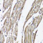 RAMP2 Antibody in Immunohistochemistry (Paraffin) (IHC (P))