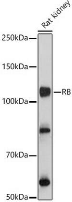 Rb Antibody in Western Blot (WB)