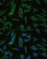 RHBDD1 Antibody in Immunocytochemistry (ICC/IF)