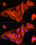 RIG-I Antibody in Immunocytochemistry (ICC/IF)