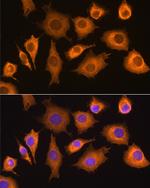 RIG-I Antibody in Immunocytochemistry (ICC/IF)