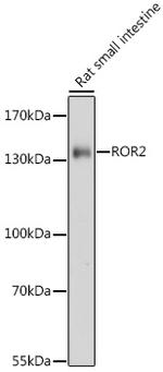 ROR2 Antibody in Western Blot (WB)