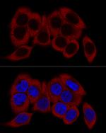 RPL23 Antibody in Immunocytochemistry (ICC/IF)