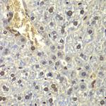 RPL5 Antibody in Immunohistochemistry (Paraffin) (IHC (P))