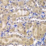 RPL5 Antibody in Immunohistochemistry (Paraffin) (IHC (P))