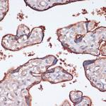 RSK3 Antibody in Immunohistochemistry (Paraffin) (IHC (P))