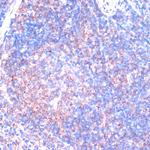 RSK3 Antibody in Immunohistochemistry (Paraffin) (IHC (P))