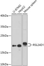 RSL24D1 Antibody in Western Blot (WB)