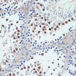 RXRG Antibody in Immunohistochemistry (Paraffin) (IHC (P))