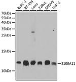 S100A11 Antibody in Western Blot (WB)