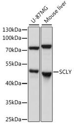 SCLY Antibody in Western Blot (WB)