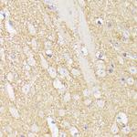 SEPT5 Antibody in Immunohistochemistry (Paraffin) (IHC (P))