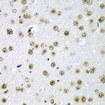 SF3B3 Antibody in Immunohistochemistry (Paraffin) (IHC (P))