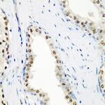 SF3B3 Antibody in Immunohistochemistry (Paraffin) (IHC (P))