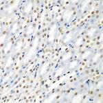 SF3B3 Antibody in Immunohistochemistry (Paraffin) (IHC (P))