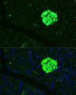 SFRP5 Antibody in Immunohistochemistry (Paraffin) (IHC (P))