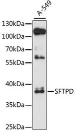 SFTPD Antibody in Western Blot (WB)