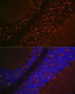 VGLUT2 Antibody in Immunohistochemistry (Paraffin) (IHC (P))