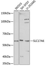 VGLUT2 Antibody in Western Blot (WB)