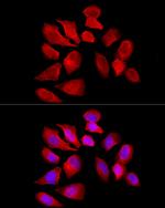 SLC22A5 Antibody in Immunocytochemistry (ICC/IF)