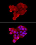 SLC22A5 Antibody in Immunocytochemistry (ICC/IF)