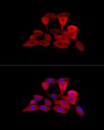 SLC22A5 Antibody in Immunocytochemistry (ICC/IF)