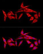 SLC27A1 Antibody in Immunocytochemistry (ICC/IF)