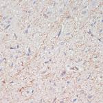 Dopamine Transporter Antibody in Immunohistochemistry (Paraffin) (IHC (P))