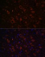 Dopamine Transporter Antibody in Immunohistochemistry (Paraffin) (IHC (P))