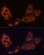 SMAP1 Antibody in Immunocytochemistry (ICC/IF)