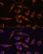 SMAP1 Antibody in Immunocytochemistry (ICC/IF)