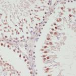 SNRNP70 Antibody in Immunohistochemistry (Paraffin) (IHC (P))