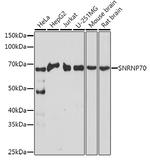 SNRNP70 Antibody in Western Blot (WB)