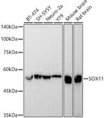 SOX11 Antibody in Western Blot (WB)