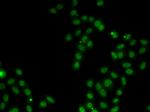 SOX5 Antibody in Immunocytochemistry (ICC/IF)