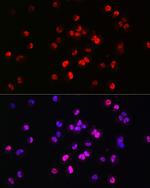 Brachyury Antibody in Immunocytochemistry (ICC/IF)