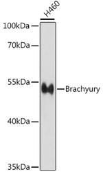 Brachyury Antibody in Western Blot (WB)