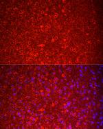 NKB Antibody in Immunocytochemistry (ICC/IF)