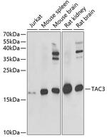 NKB Antibody in Western Blot (WB)