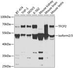 TFCP2 Antibody in Western Blot (WB)