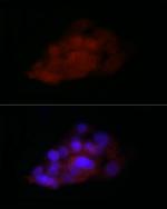 TIA-1 Antibody in Immunocytochemistry (ICC/IF)