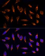 TOM20 Antibody in Immunocytochemistry (ICC/IF)