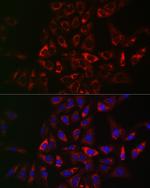 TRAF3IP2 Antibody in Immunocytochemistry (ICC/IF)