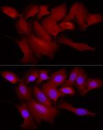 TRIM21 Antibody in Immunocytochemistry (ICC/IF)