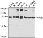 HIP2 Antibody in Western Blot (WB)