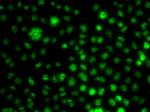 UBE2R2 Antibody in Immunocytochemistry (ICC/IF)