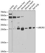 UBE2R2 Antibody in Western Blot (WB)