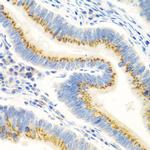 UBIAD1 Antibody in Immunohistochemistry (Paraffin) (IHC (P))