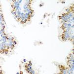 UBIAD1 Antibody in Immunohistochemistry (Paraffin) (IHC (P))