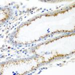 UBIAD1 Antibody in Immunohistochemistry (Paraffin) (IHC (P))